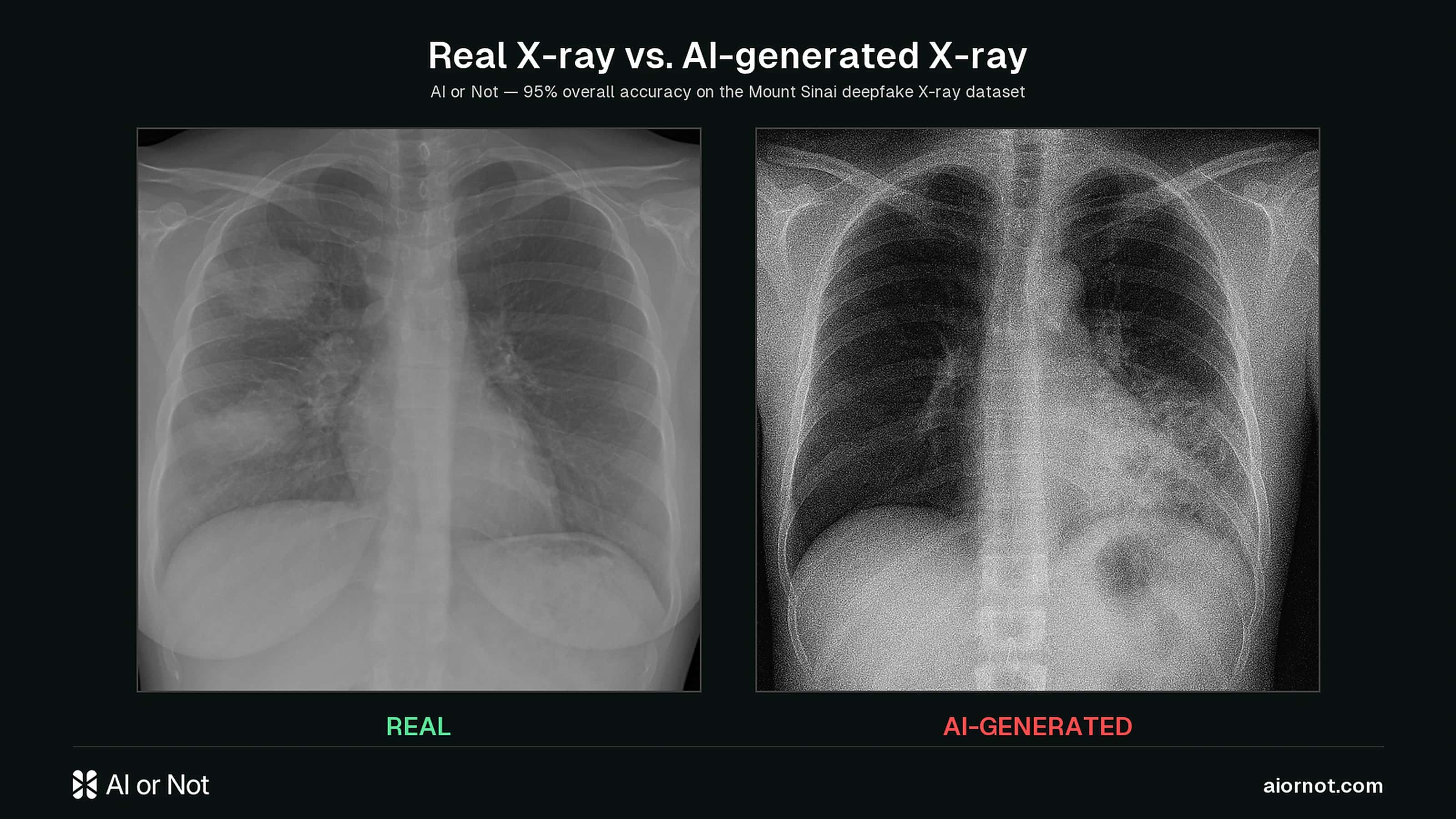 Side-by-side comparison: an authentic chest X-ray next to a GPT-4o-generated chest X-ray, on the AI or Not brand background